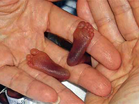Fotografa El tamao de los pies del beb dan muestran su escasa gestacin
